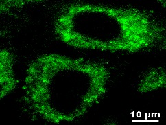 GFP